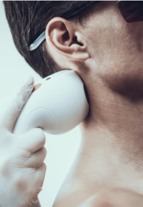 A man getting laser hair removal on the back of his neck.