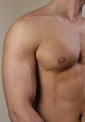 The well sculpted and completely smooth shoudler and pecs of a male showing the result of hair removal.