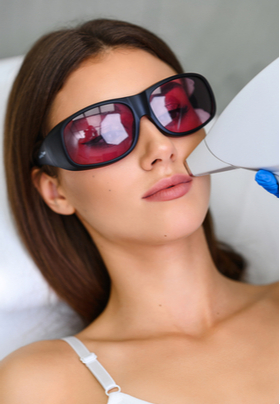 Woman getting laser hair removal on her upper lip.